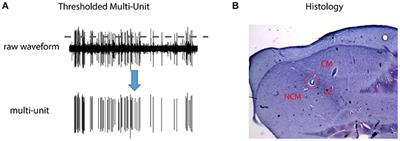 Neural Correlate of Transition Violation and Deviance Detection in the Songbird Auditory Forebrain